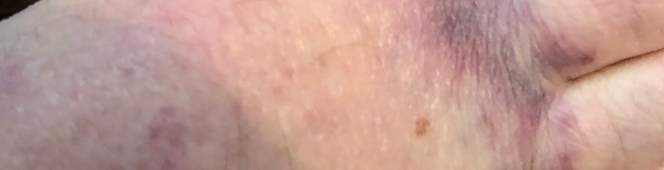 Klus…boem…voet…